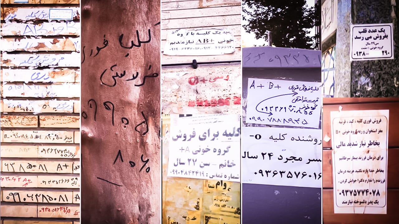 Iran’s trade in organs exploits the poor