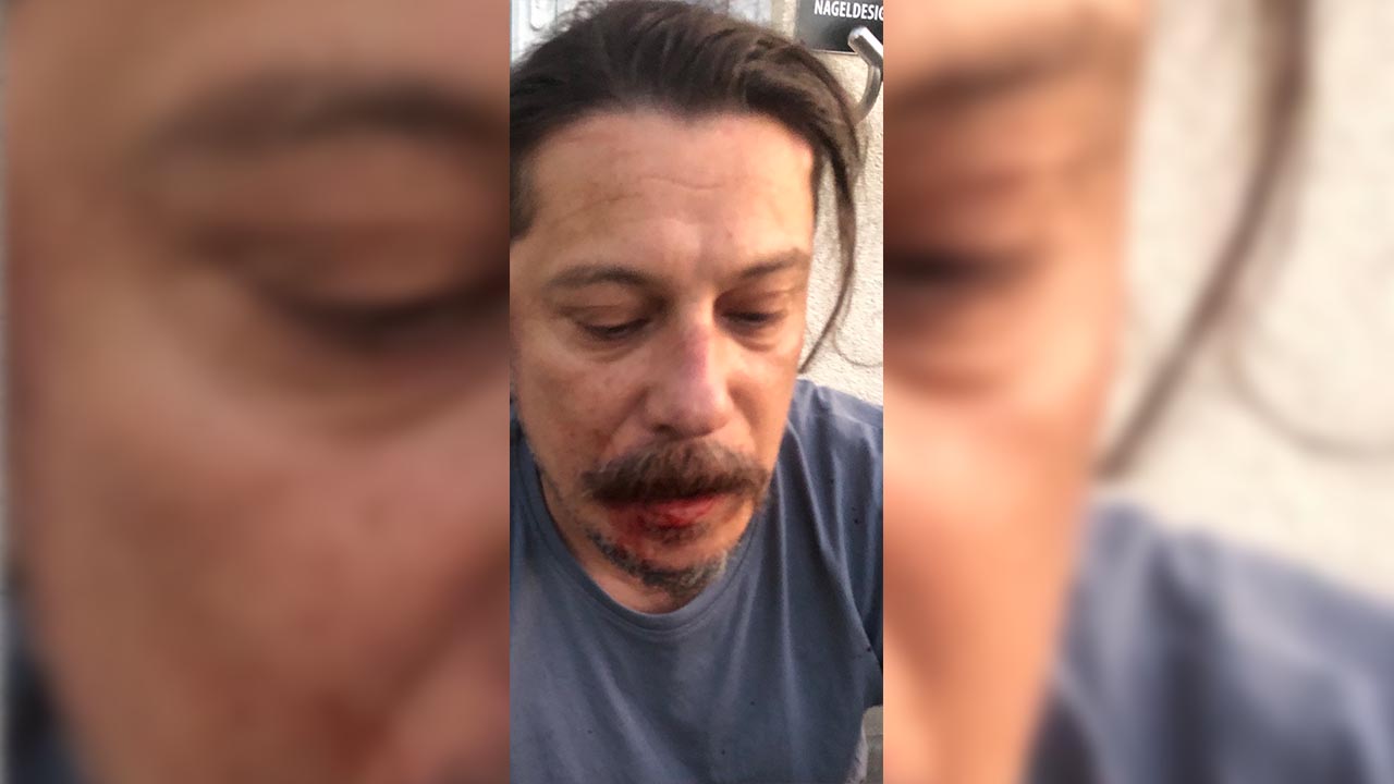 Turkish journalist critical of Erdoğan brutally attacked in Germany