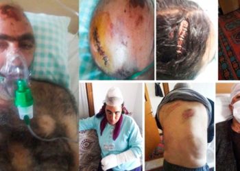 Bar associations urge Turkish authorities to effectively investigate racist attacks targeting Kurds