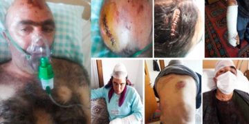 Bar associations urge Turkish authorities to effectively investigate racist attacks targeting Kurds