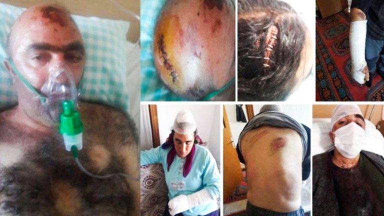 Bar associations urge Turkish authorities to effectively investigate racist attacks targeting Kurds
