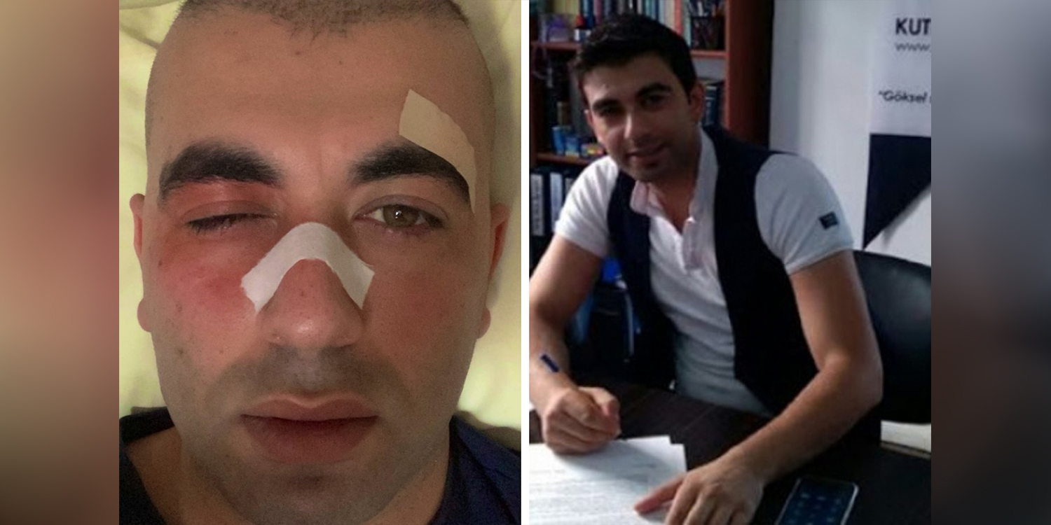 Kurdish author Gökhan Yavuzel on the attack in Wales: ‘This was a pre-planned assault’