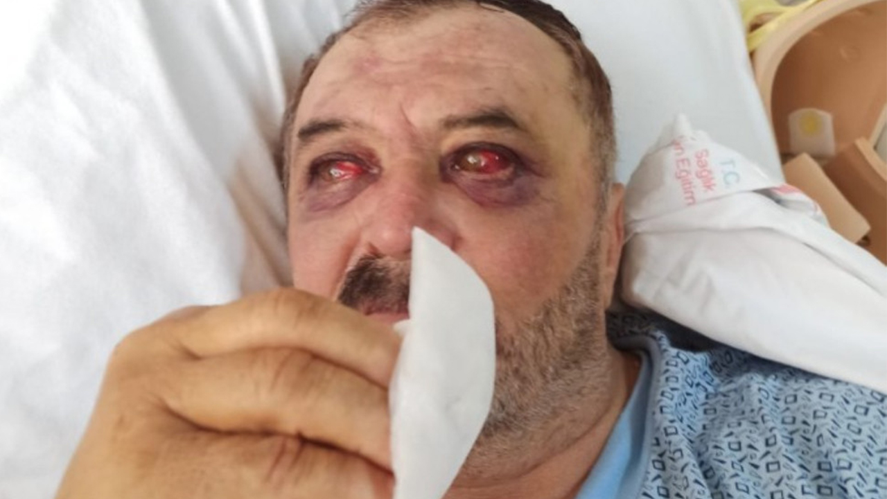 Kurdish villager who’d remained in coma after lynching by soldiers face ‘terrorism’ charge