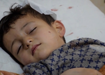 Northeast Syria: Four-year-old Ebdo lost a leg in Turkish attack