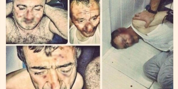 Turkish governor in torture case: ‘It only happened once!’