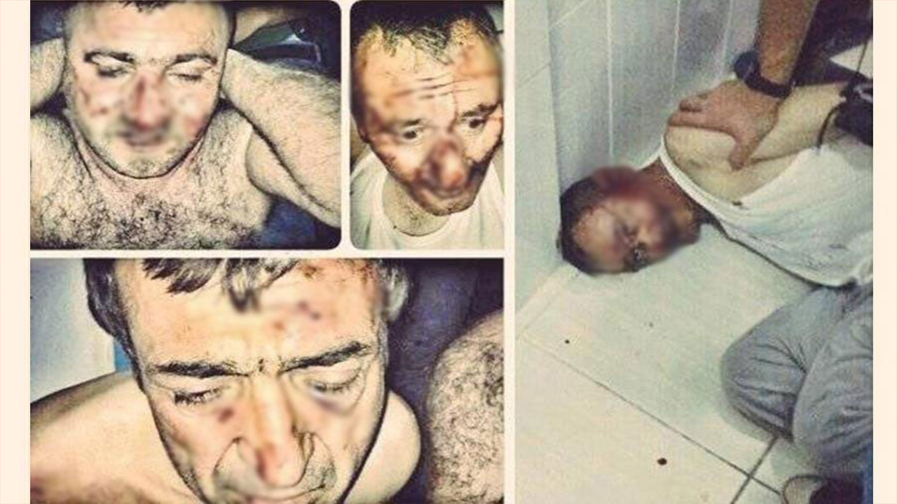 Turkish governor in torture case: ‘It only happened once!’