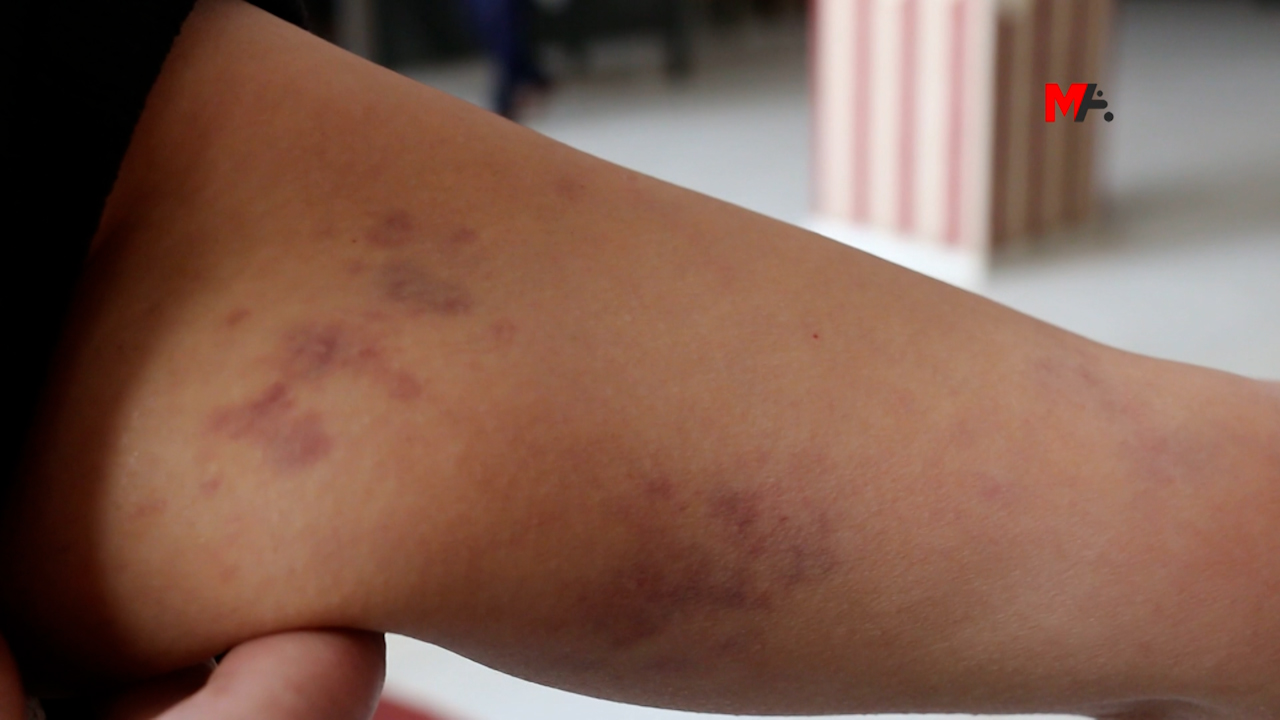 Lawyer testifies to being beaten by Turkish troops in military headquarters