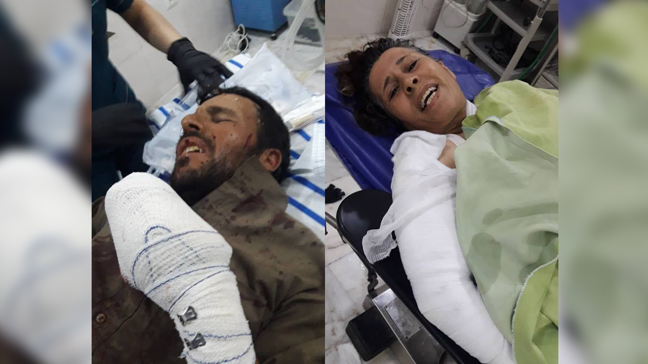At least one child killed by Turkish shelling in Kobane