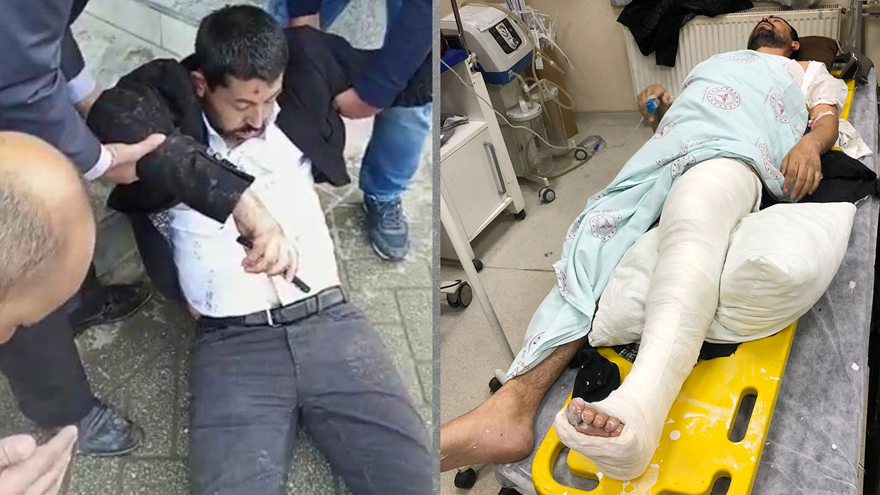 Kurdish MP undergoes surgery after brutal Turkish police attack