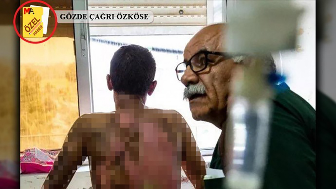 Expert doctor urged Turkey to allow investigation into region exposed to chemical gas