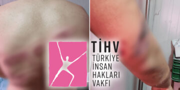 Report by Turkish human rights foundation reveals state-sanctioned violations following earthquakes