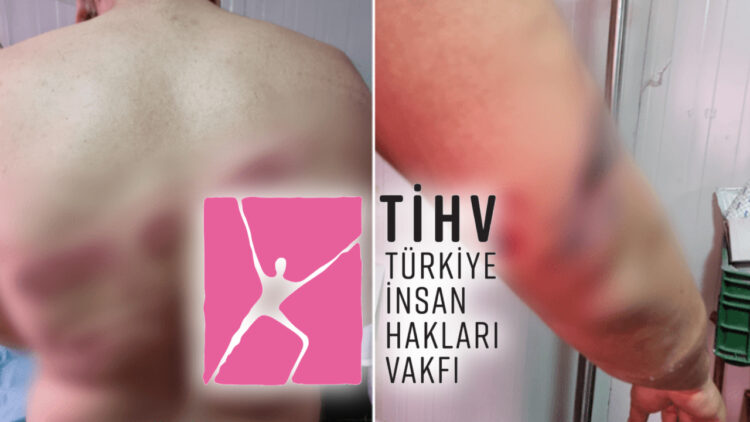 Report by Turkish human rights foundation reveals state-sanctioned violations following earthquakes