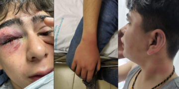 Turkey detains five police officers for torture of 14-year-old during Newroz