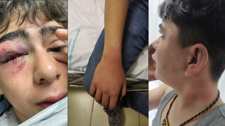 Turkey detains five police officers for torture of 14-year-old during Newroz