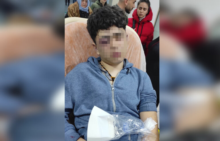 Boy, 14, tortured and dumped in swamp by Turkish police