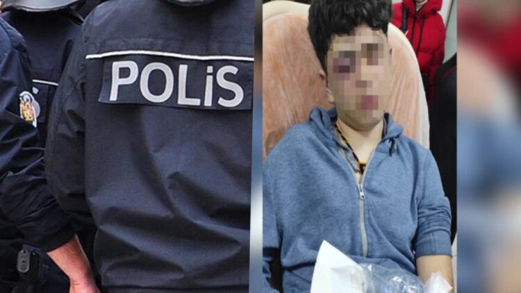 Turkish prosecutor charges police officers accused of torturing teenager with deprivation of liberty