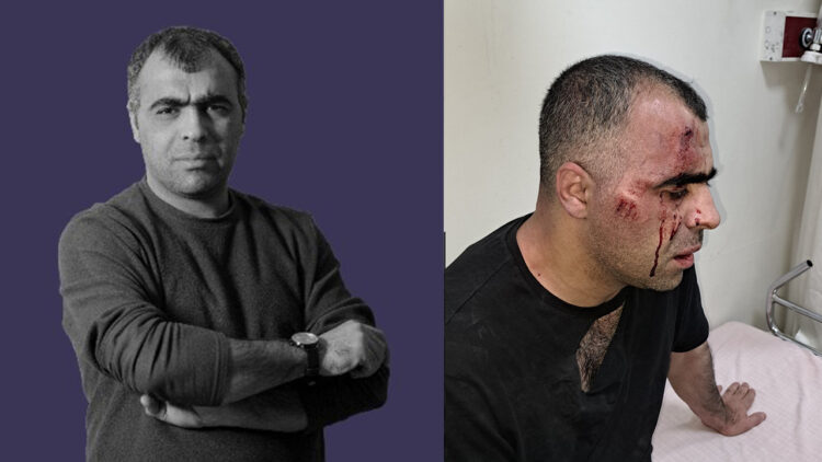 Corruption exposé triggers attack on journalist Sinan Aygül in Turkey