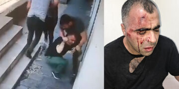 Journalist Sinan Aygül attacked: Bar associations condemn assault on press freedom