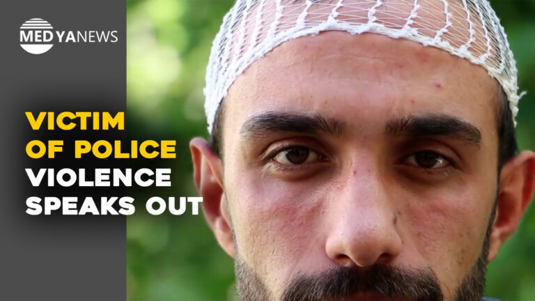 Victim of police violence speaks out on ongoing threats in Turkey’s Kurdish-majority city