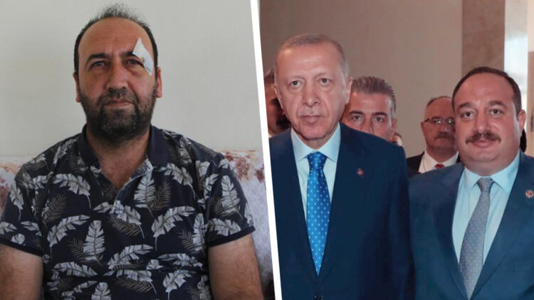 Journalist assaulted allegedly for exposing corruption in Turkey’s Kurdish-majority district