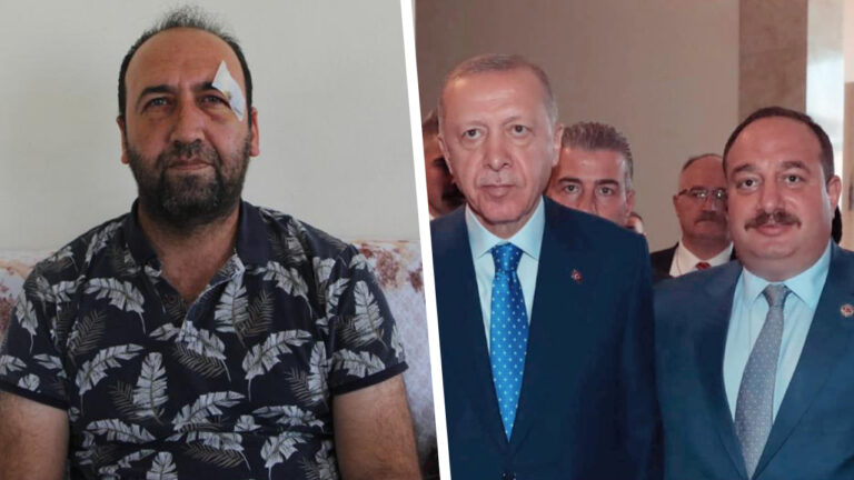 Journalist assaulted allegedly for exposing corruption in Turkey’s Kurdish-majority district