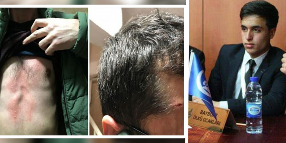 Turkish court rejects pre-trial detention for suspect of armed assault on pro-Kurdish opposition offices