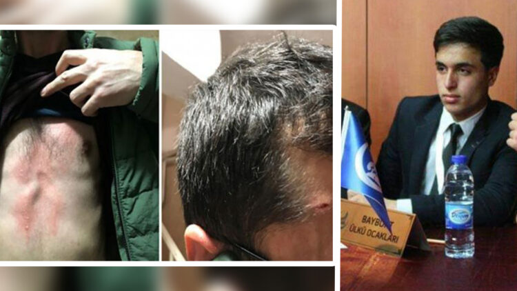 Turkish court rejects pre-trial detention for suspect of armed assault on pro-Kurdish opposition offices