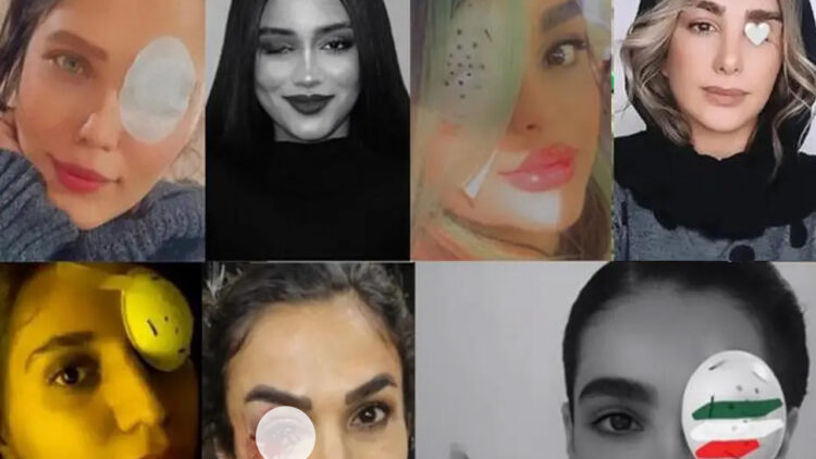 Eyes of female protesters systematically targeted by Iran’s security forces: watchdog releases statistics