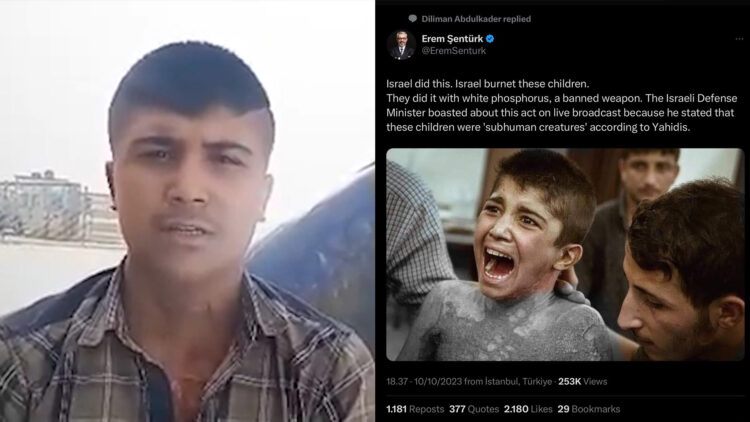 Kurdish boy injured in 2019 Turkish attack speaks out against misinformation
