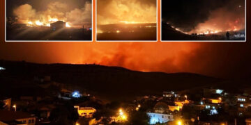 Insufficient burns units cause excessive deaths from fire in Kurdish southeast Turkey