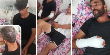 Turkish mob uses knives, machetes to attack Kurdish workers