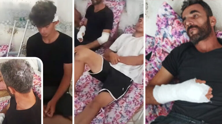 Turkish mob uses knives, machetes to attack Kurdish workers