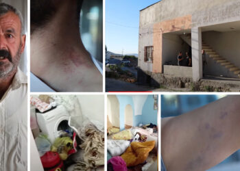 Police raid in Mardin leaves Kalkan family injured, including pregnant woman