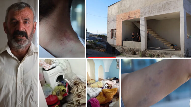 Police raid in Mardin leaves Kalkan family injured, including pregnant woman
