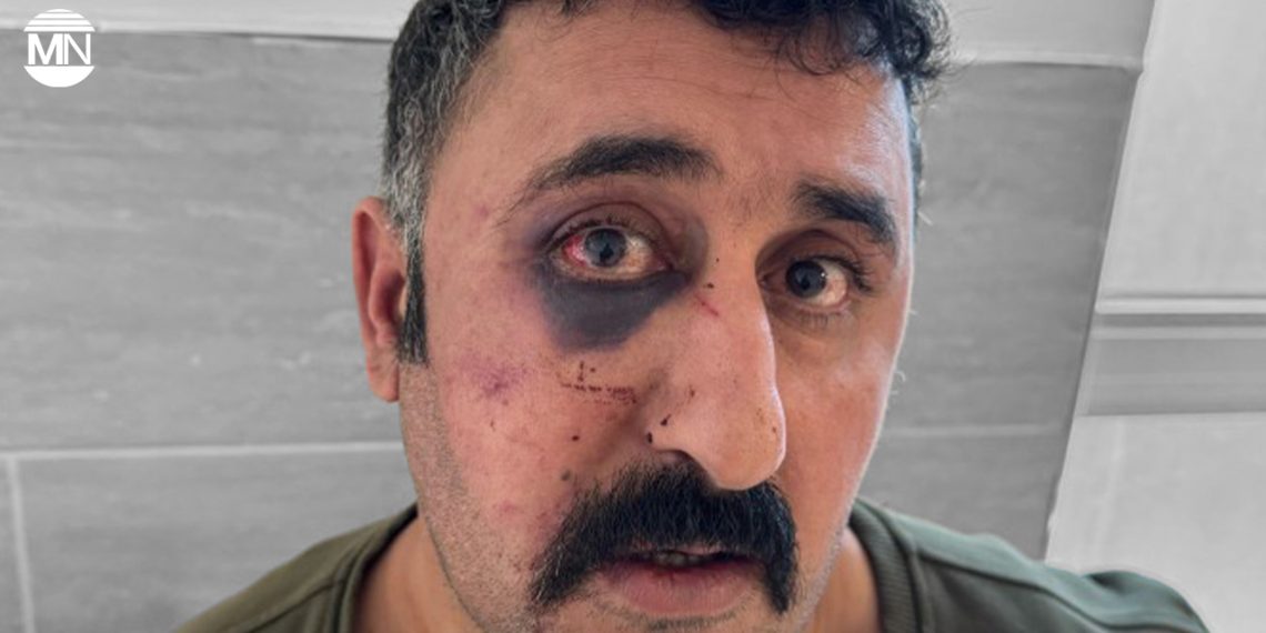 Turkish police assault lawyer documenting torture of Kurdish client