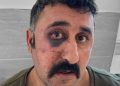 Turkish police assault lawyer documenting torture of Kurdish client