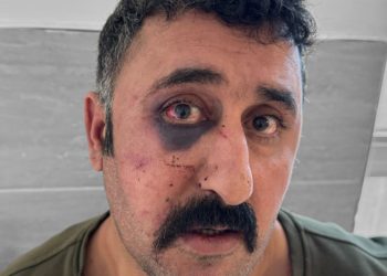 Turkish police assault lawyer documenting torture of Kurdish client