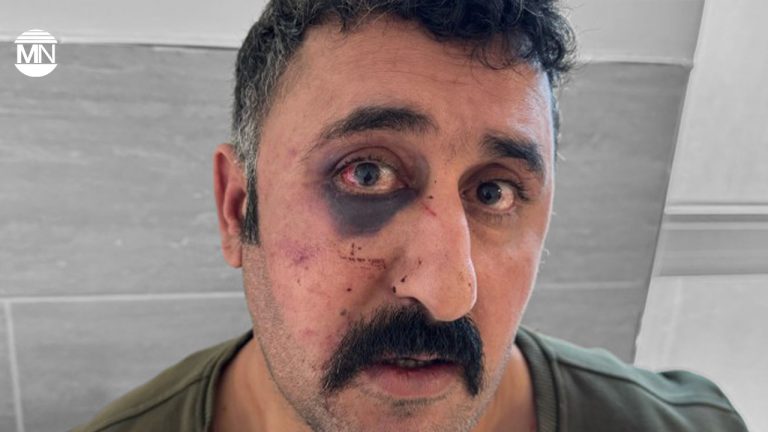 Turkish police assault lawyer documenting torture of Kurdish client